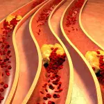 Colesterolo alto: cosa mangiare per risolvere il problema